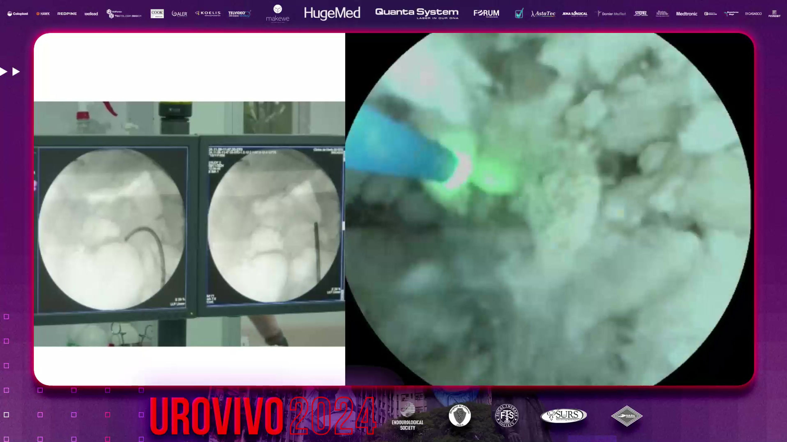 UROVIVO 2024